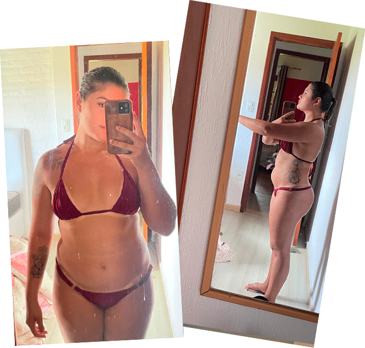 Depois - foto de frente